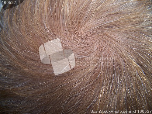 Image of Hair