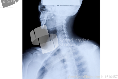 Image of Upper Body X-ray