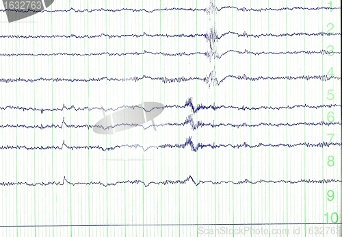 Image of electro-encephalogramme