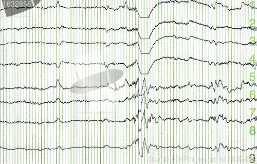 Image of electro-encephalogramme