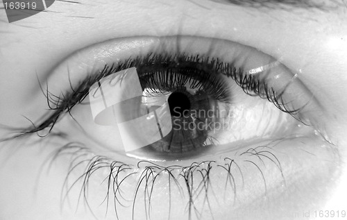 Image of Female eye