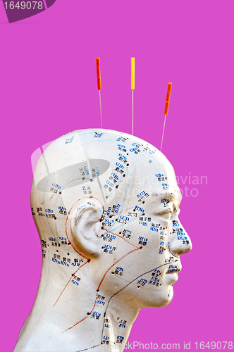 Image of Acupuncture needles on head model
