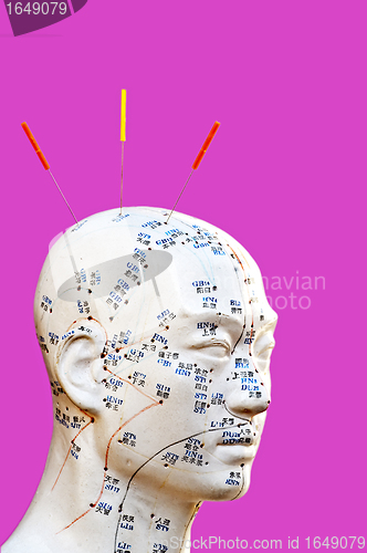 Image of Acupuncture needles on head model