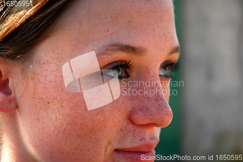 Image of freckles