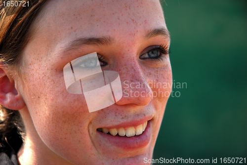 Image of freckles