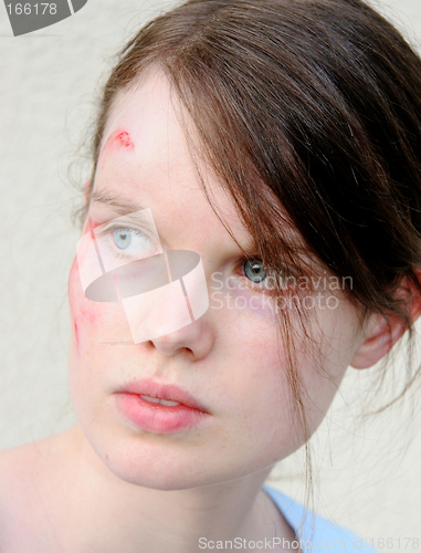 Image of Injured woman 1