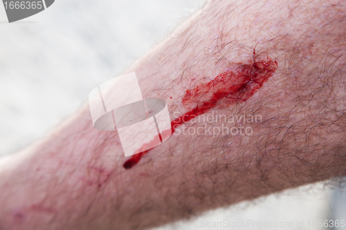 Image of Blood on a male leg. Injury, accident