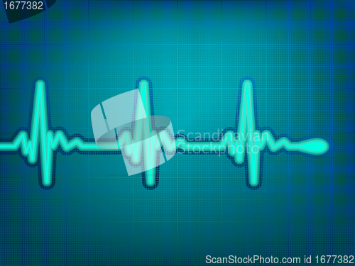 Image of Normal electronic cardiogram. EPS 8