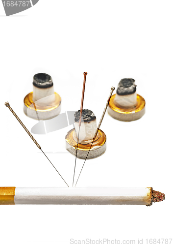 Image of acupuncture to stop smoking