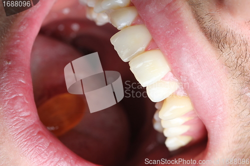 Image of open mouth