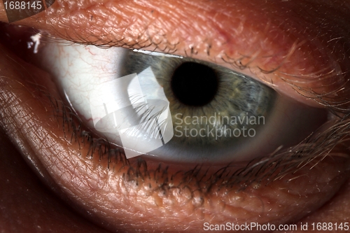 Image of eyeball