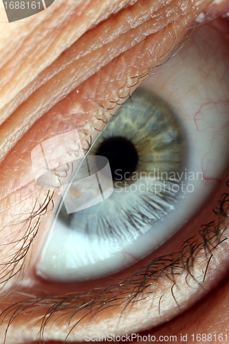 Image of eyeball