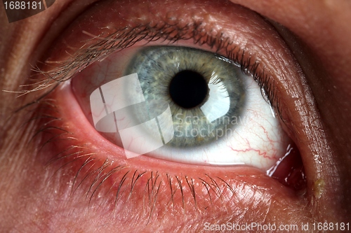 Image of eyeball