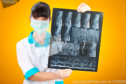 Image of Doctor with xray