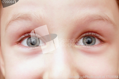 Image of eyes