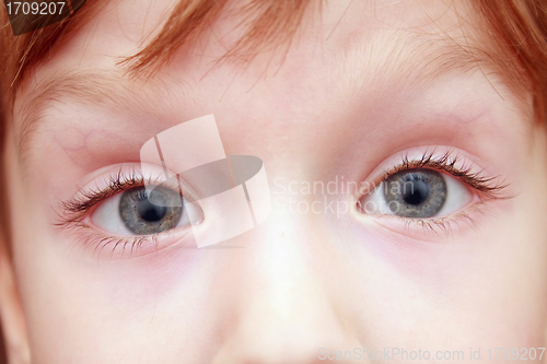 Image of eyes