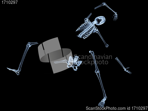 Image of Shattered Skeleton