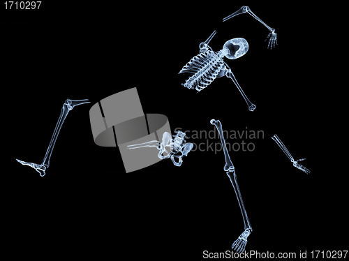 Image of Shattered Skeleton