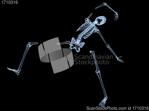 Image of Shattered Skeleton