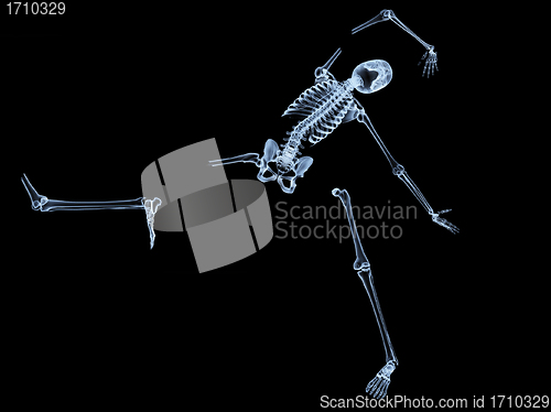 Image of Shattered Skeleton