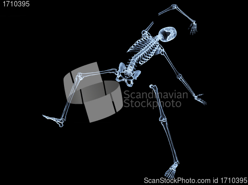 Image of Shattered Skeleton