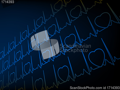 Image of ECG tracing monitor. EPS 8