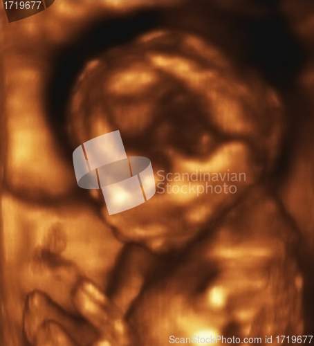 Image of Ultrasonography Analysis of a 4th Month Fetus
