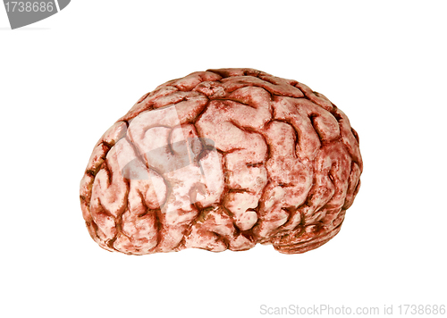 Image of human brain