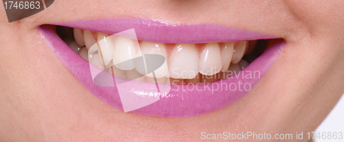 Image of Close-up of female smile with healthy teeth