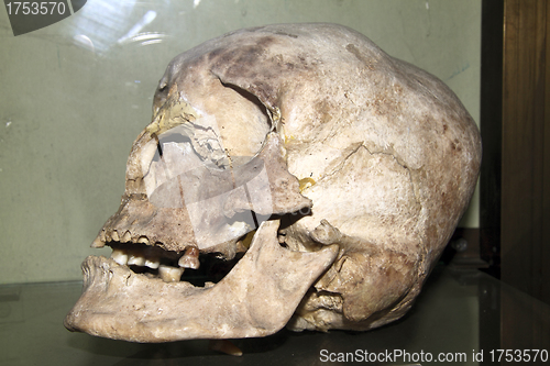 Image of model of the human skull