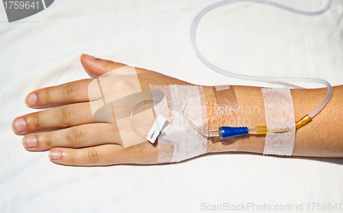 Image of Medical intravenous cannula on hand