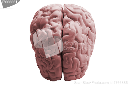 Image of The human brain