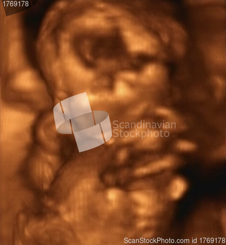 Image of Three Dimensional Ultrasound