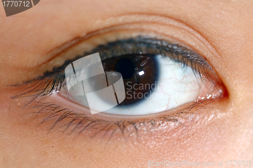 Image of Woman eyes