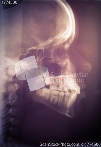 Image of Human skull scan