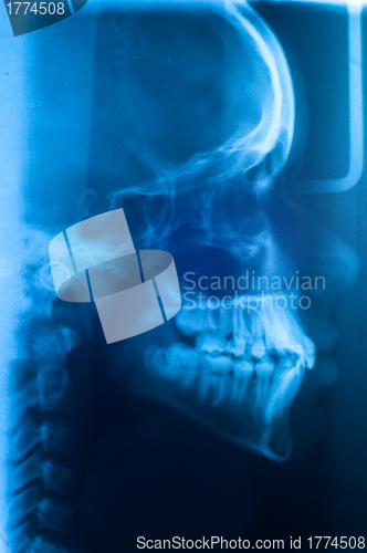 Image of Human skull scan