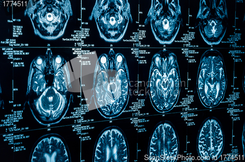 Image of A group of CAT scans of the human brain