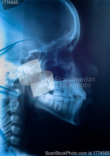 Image of Medical scan of the human head