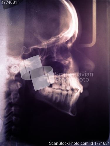 Image of Human skull scan