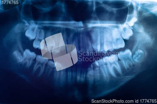 Image of Closeup of the human skull