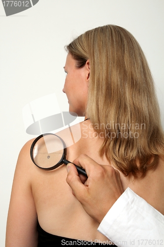 Image of Woman with birthmark