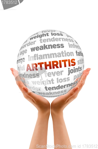 Image of Arthritis