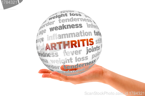 Image of Arthritis