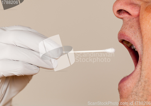 Image of DNA swab of saliva taken from senior man