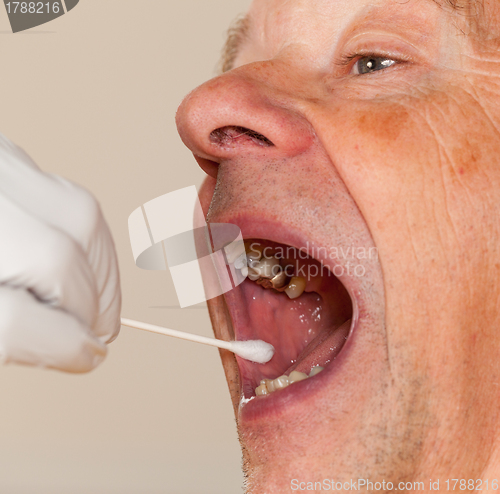 Image of DNA swab of saliva taken from senior man