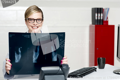 Image of Female surgeon showing x-ray reports to camera