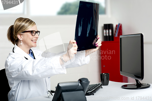 Image of Female doctor looking at x-ray report of patient