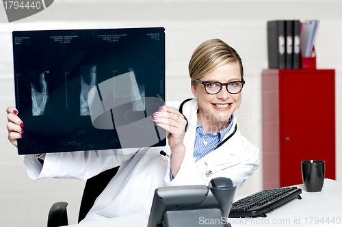 Image of Medical surgeon expert holding x-ray report