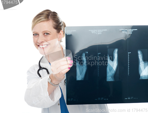 Image of Female surgeon holding x-ray report