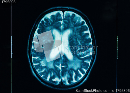 Image of sharp ct scan of the human brain